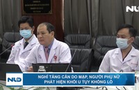 Khối u khổng lồ hiếm gặp che kín nửa mặt người phụ nữ