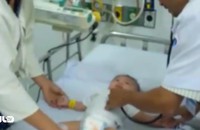 Bé trai bị đâm xuyên sọ nhập viện do viêm màng não