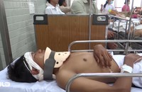 218 ca chấn thương sọ não cấp cứu tại Bệnh viện Chợ Rẫy sau 4 ngày nghỉ lễ