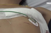 Cứu sống thanh niên bị đâm thủng tim