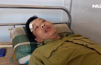 Kiểm lâm Vườn Quốc gia Yók Đôn kể lại giây phút bị lâm tặc tấn công