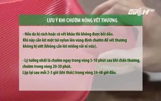 Khi bị chấn thương: Chườm nóng hay chườm lạnh?