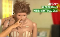 Cách phòng và sơ cứu khi chảy máu cam