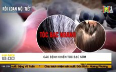 Các bệnh khiến tóc bạc sớm