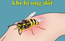 Cách xử trí kịp thời khi bị ong đốt