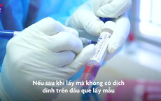 Cách lấy mẫu xét nghiệm SARS-CoV-2 theo hướng dẫn của Bộ Y tế để không bị âm tính giả