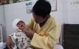 bé Vừ Thị Kê 23 tháng tuổi, người dân tộc H'Mông bị bỏng nặng do ngã vào bếp lửa