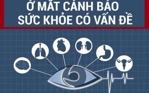 Dấu hiệu bất thường ở mắt cảnh báo sức khỏe có vấn đề