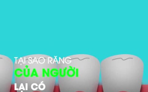 Tại sao con người có 32 chiếc răng?