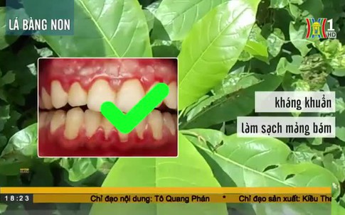 Cách chữa viêm lợi đơn giản, hiệu quả