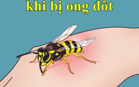 Cách xử trí kịp thời khi bị ong đốt