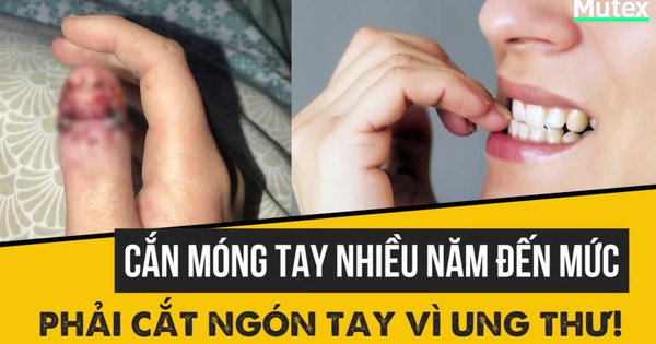 Cắn móng tay nhiều đến mức phải cắt ngón tay vì ung thư